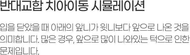 ݴ뱳  ݾ  Ʒ մϰ Ϻ   
ǹմϴ.  ,   ִ  
Դϴ.