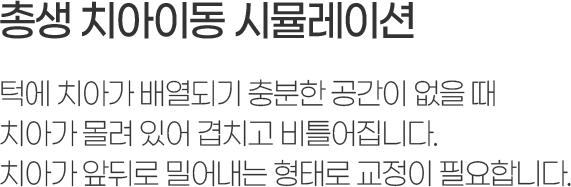 ѻ ο ġư 迭Ǳ    
ġư  ־ ġ Ʋϴ.
ġư յڷ о ·  ʿմϴ.
